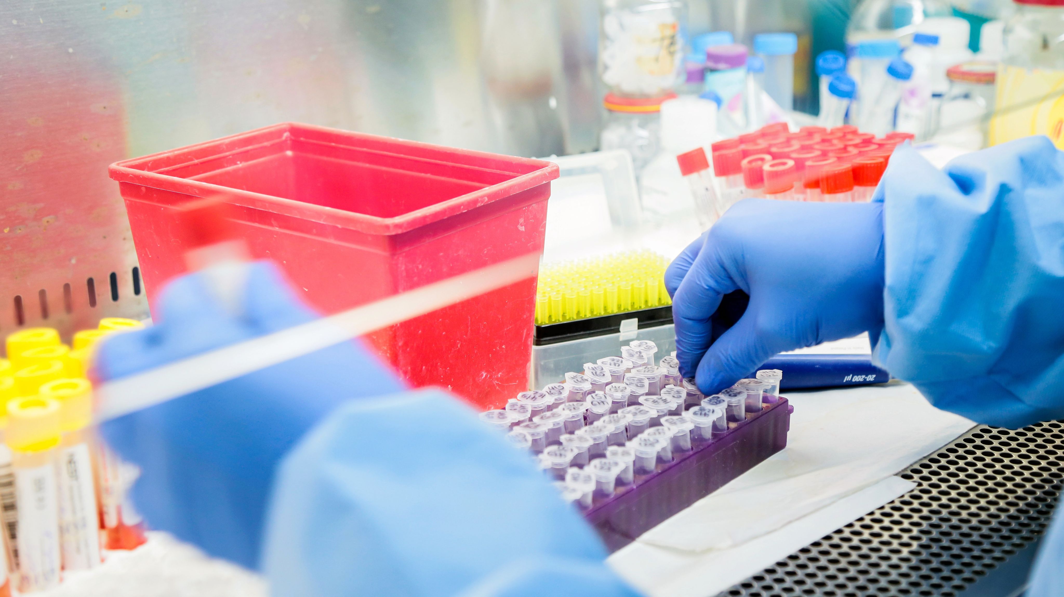 Muestra de pruebas covid en un laboratorio en Benin. Financiado por el Banco Mundial, el Proyecto de fortalecimiento de los sistemas regionales de vigilancia de enfermedades (REDISSE III) ha proporcionado a Benin equipos de cuidados intensivos y reanimación para pacientes con COVID-19.